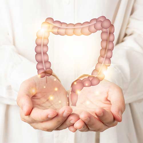 Factori de risc în cancerul colorectal