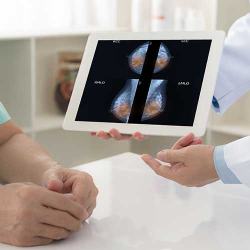 Circuitul pacientei cu cancer de sân
