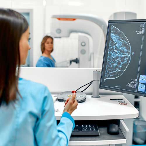 Monitorizarea pacientei cu cancer de san