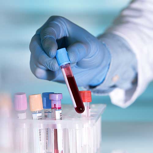 investigatii oncologie